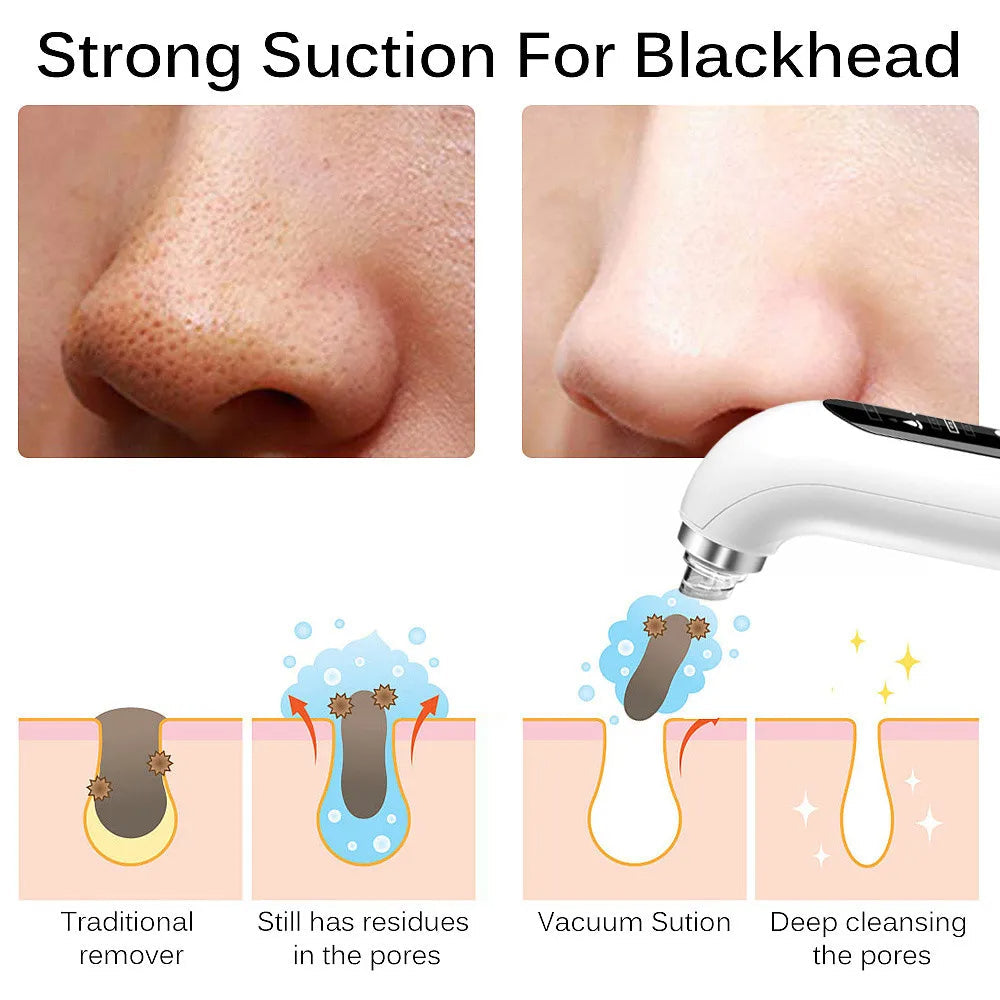 Electric blackhead remover pore vacuum on white background, featuring ergonomic design with interchangeable suction heads.
