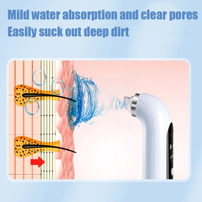 Electric blackhead remover pore vacuum on white background, featuring ergonomic design with interchangeable suction heads.