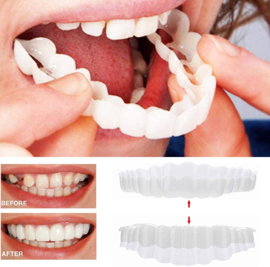 "Smile veneer set with upper and lower pieces, natural white finish, for beauty and wellbeing, transforms imperfect teeth."