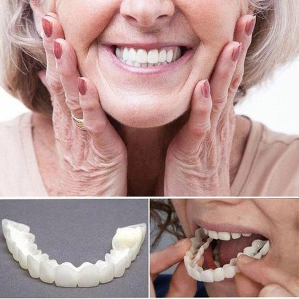 "Smile veneer set with upper and lower pieces, natural white finish, for beauty and wellbeing, transforms imperfect teeth."