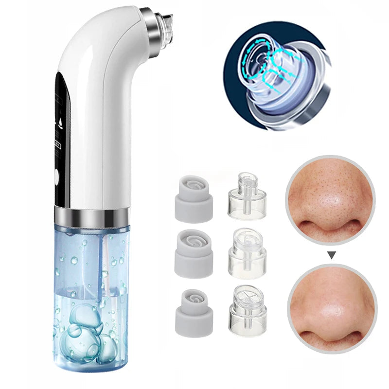 "Unisex electric blackhead remover vacuum, sleek design, adjustable suction for skin cleansing, front view."