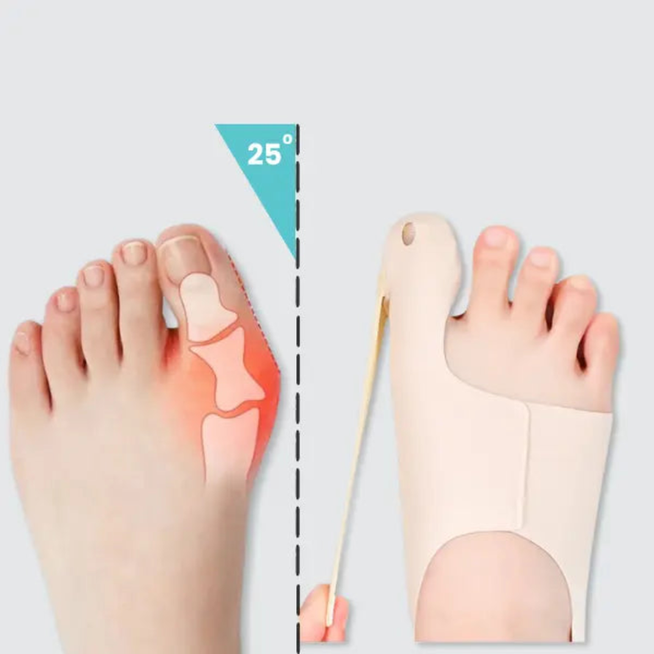 Soft unisex bunion corrector sleeve provides comfortable toe alignment & pain relief. Ideal for discreet daily wear.