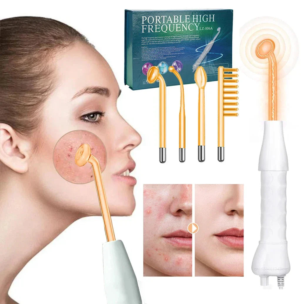 "Unisex high-frequency skin tightening wand for wrinkle reduction and acne treatment, featuring compact neon argon design."