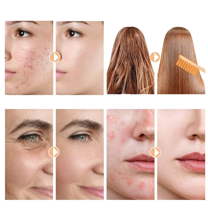 "Unisex high-frequency skin tightening wand for wrinkle reduction and acne treatment, featuring compact neon argon design."