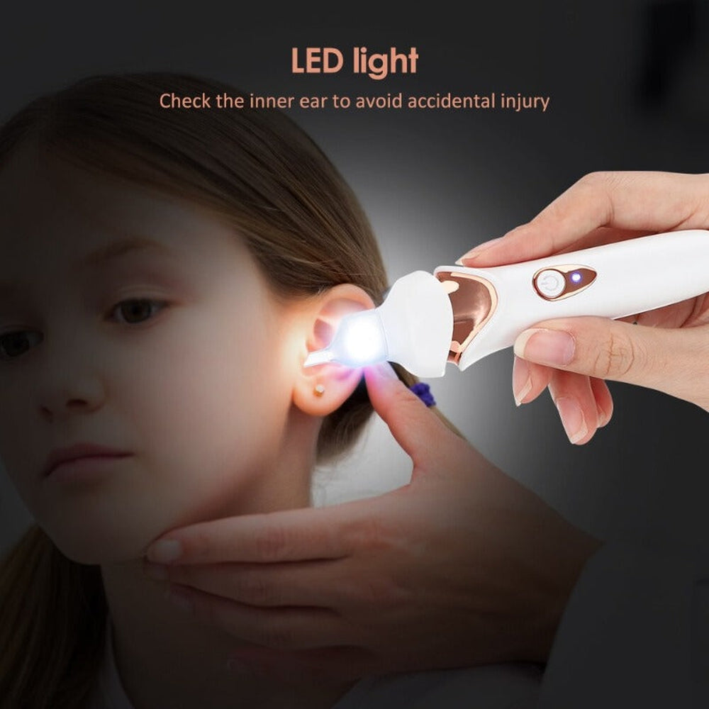 Unisex painless earwax vacuum cleaner with gentle suction and LED light for safe, effective ear hygiene.